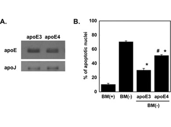 Western Blot using APOJ